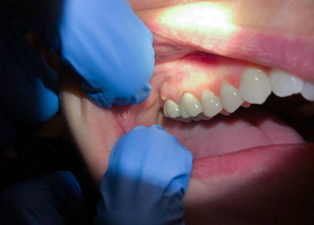 Best Emergency Dental Services for Seniors in Lexico, CA